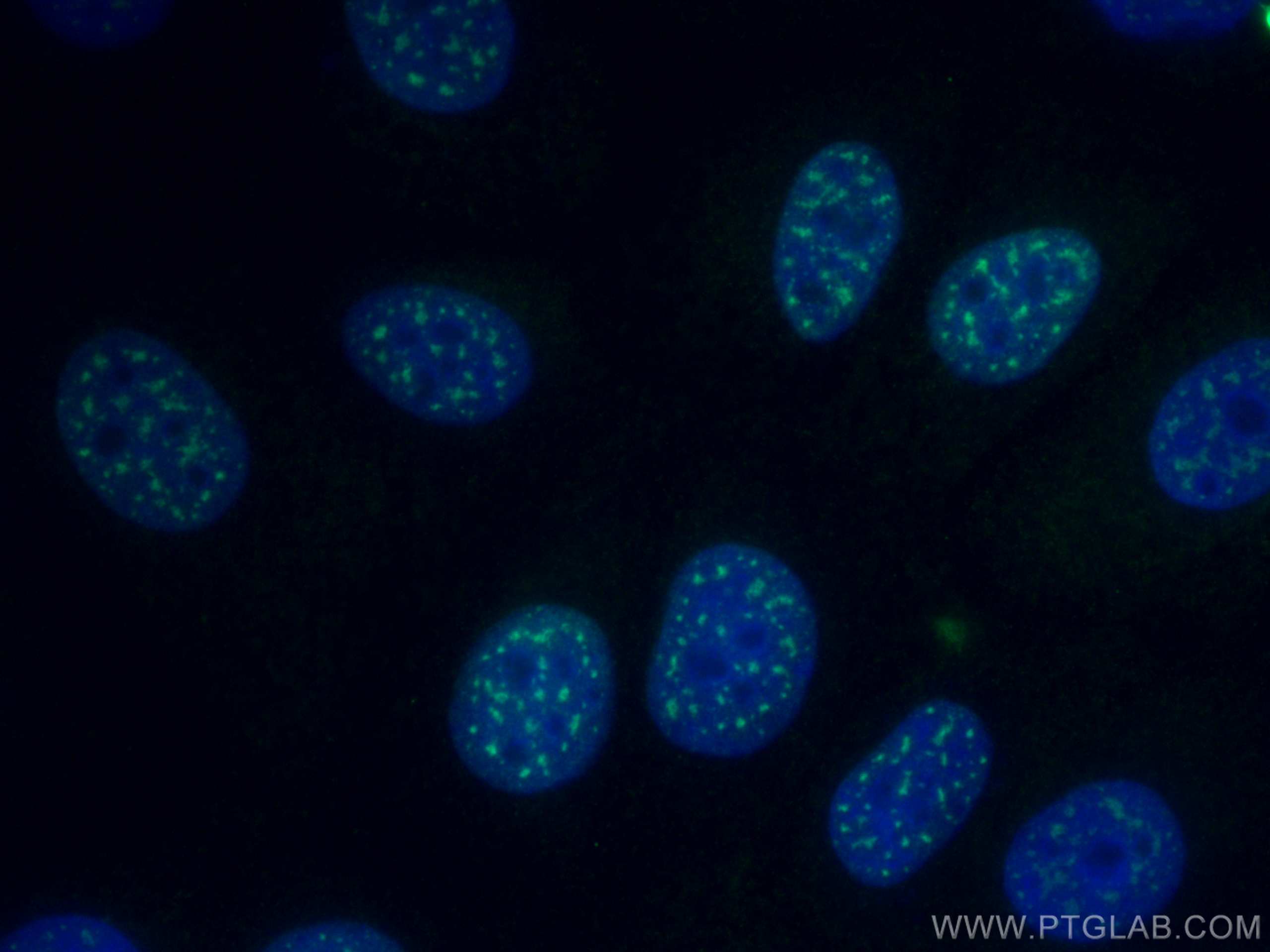 Immunofluorescence (IF) / fluorescent staining of MCF-7 cells using Phospho-Histone H3 (Ser10) Monoclonal antibody (66863-1-Ig)