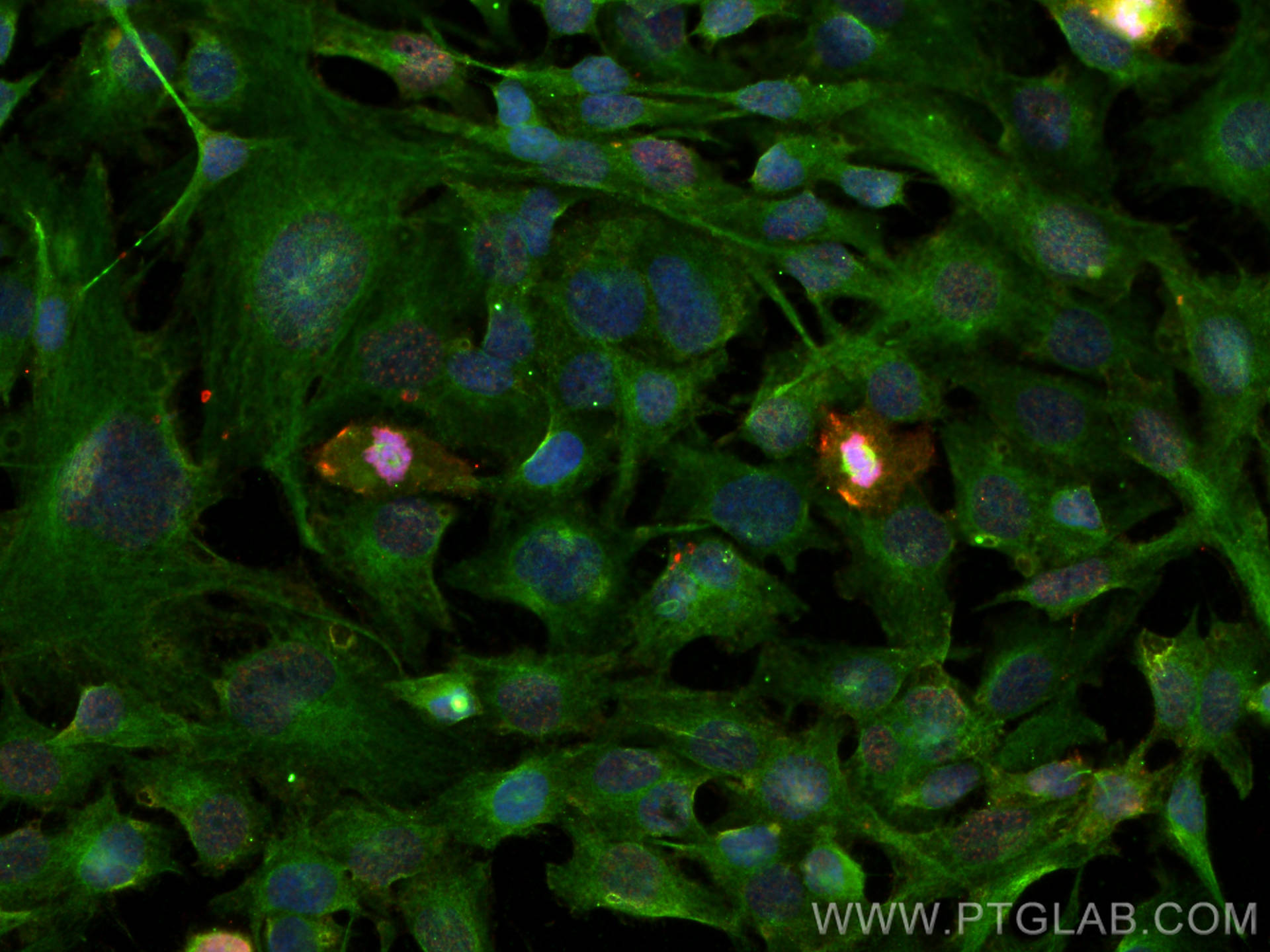 Immunofluorescence (IF) / fluorescent staining of SKOV-3 cells using Phospho-Histone H3 (Ser10) Monoclonal antibody (66863-1-Ig)