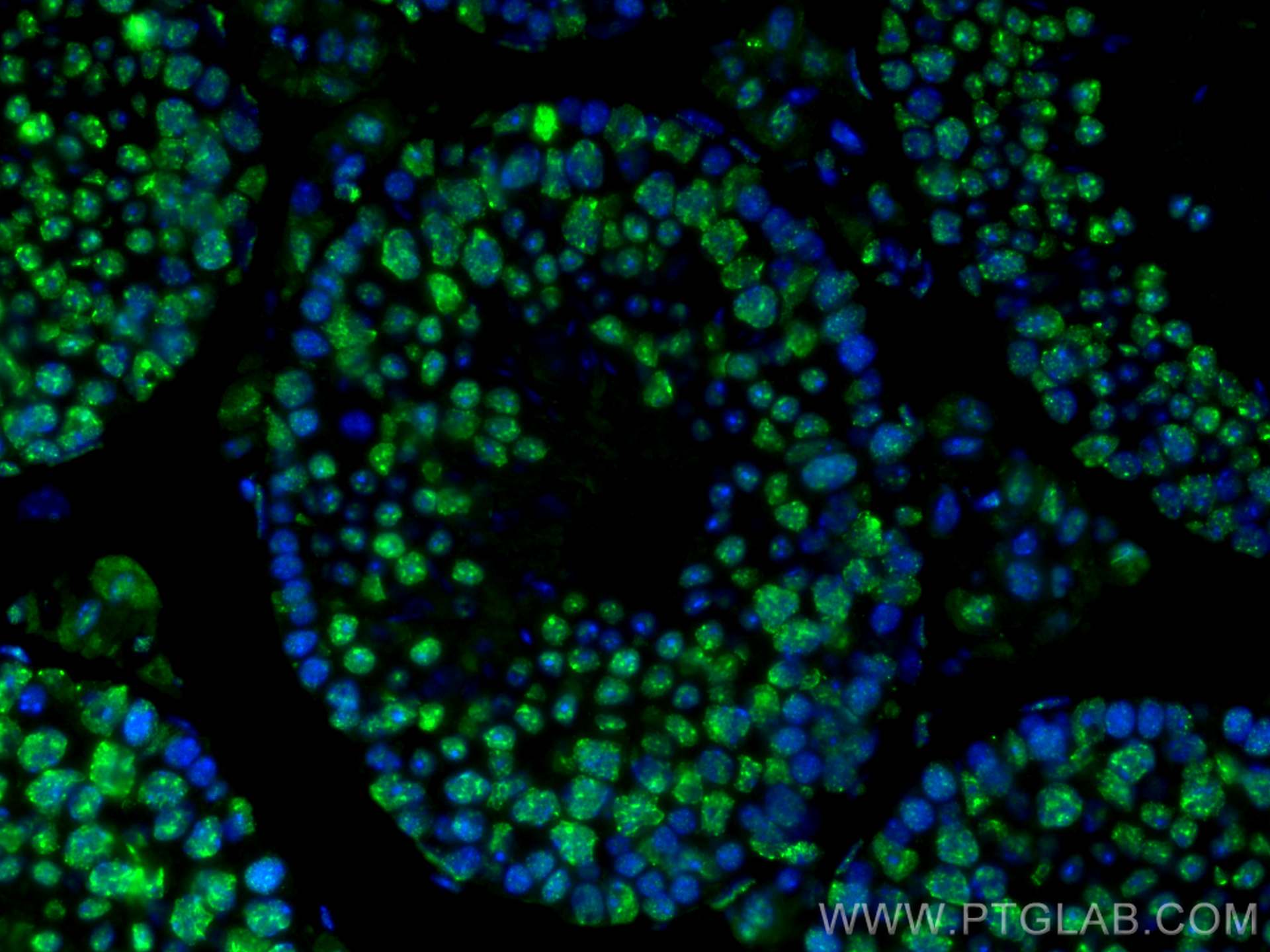 Immunofluorescence (IF) / fluorescent staining of mouse testis tissue using Phospho-Histone H3 (Ser10) Monoclonal antibody (66863-1-Ig)