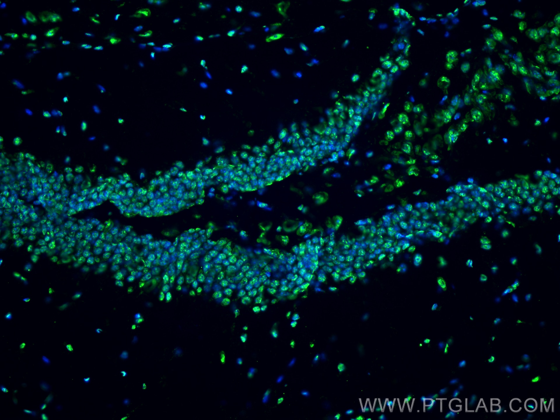 Immunofluorescence (IF) / fluorescent staining of mouse brain tissue using Phospho-Histone H3 (Ser10) Monoclonal antibody (66863-1-Ig)