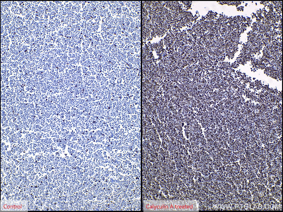 IHC staining of Jurkat using 66863-1-Ig