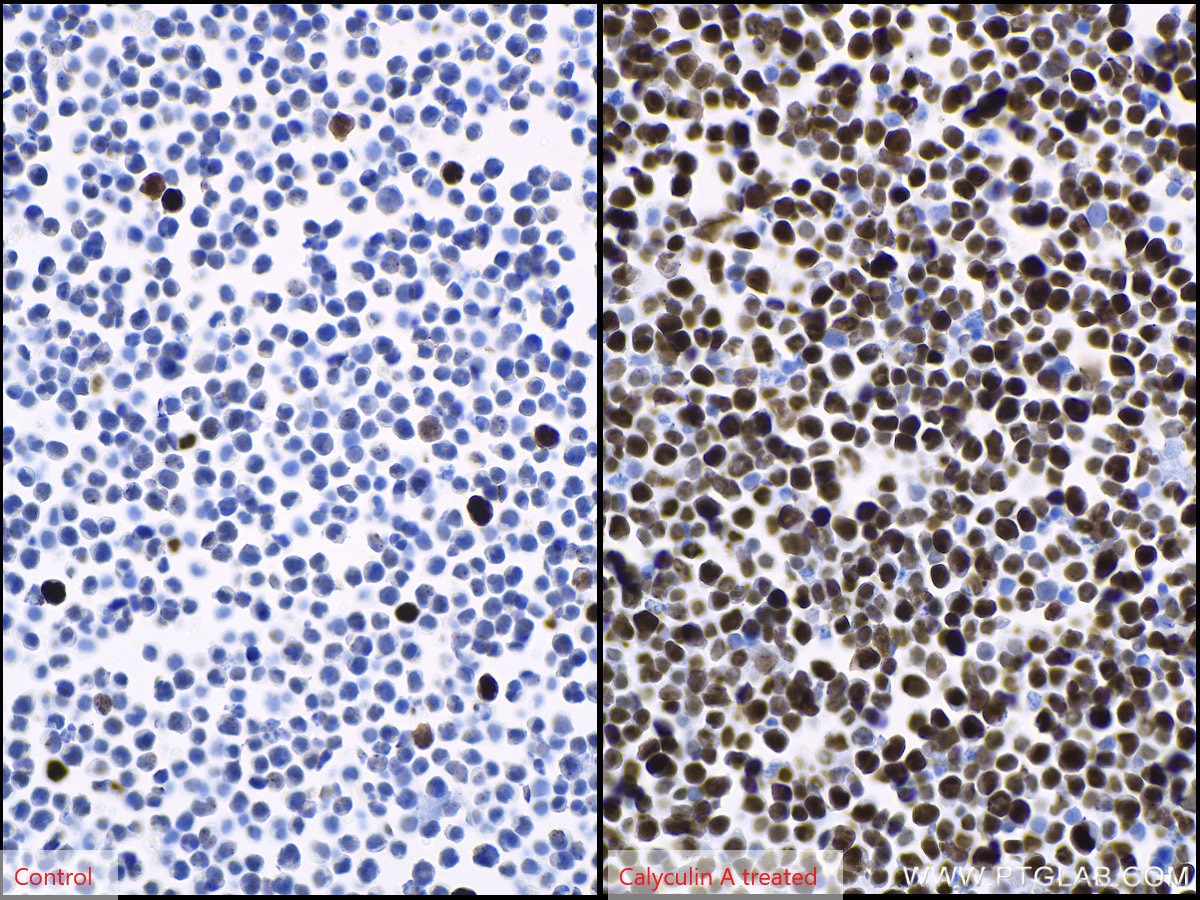 IHC staining of Jurkat using 66863-1-Ig