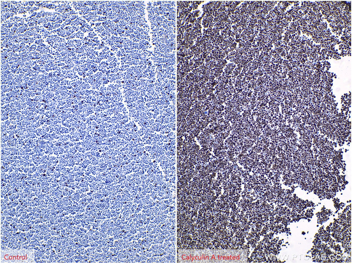 IHC staining of Jurkat using 66863-1-Ig