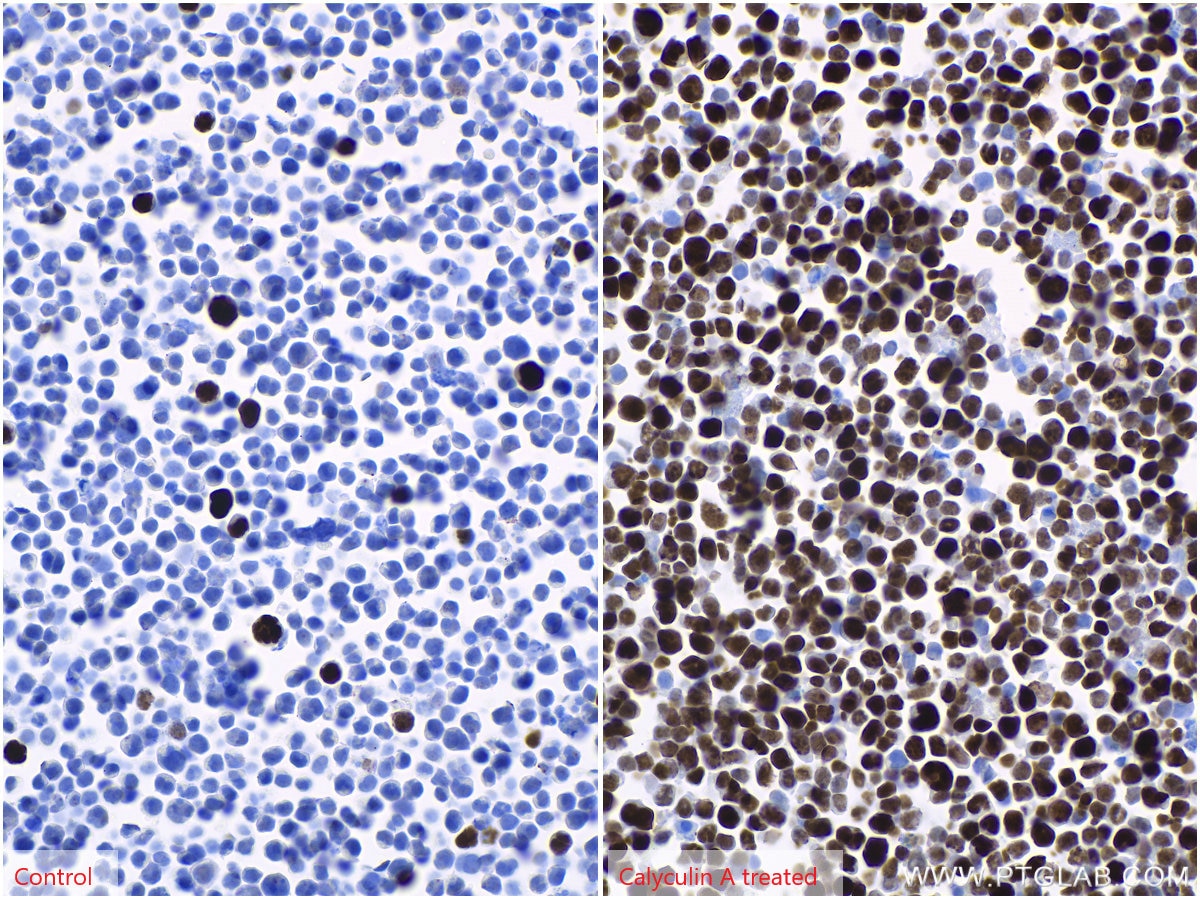 Immunohistochemistry (IHC) staining of Jurkat cells using Phospho-Histone H3 (Ser10) Monoclonal antibody (66863-1-Ig)