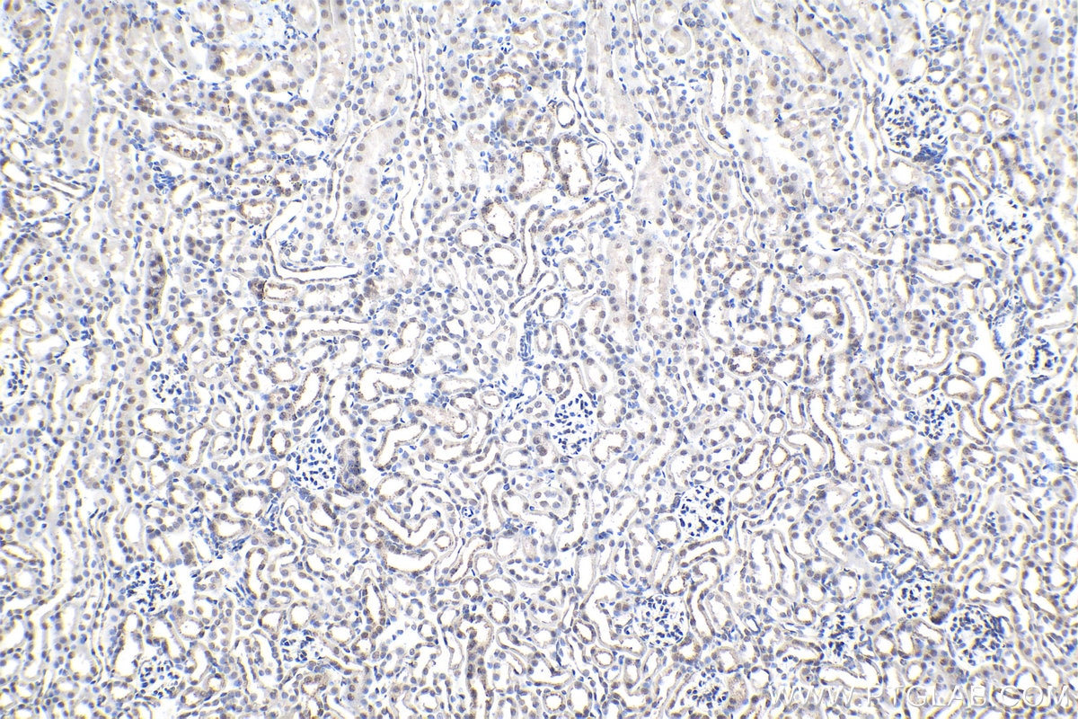 Immunohistochemistry (IHC) staining of mouse kidney tissue using Phospho-Histone H3 (Ser10) Monoclonal antibody (66863-1-Ig)