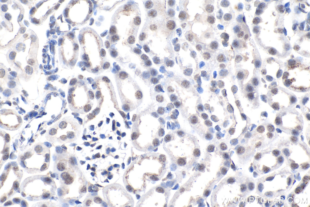 Immunohistochemistry (IHC) staining of mouse kidney tissue using Phospho-Histone H3 (Ser10) Monoclonal antibody (66863-1-Ig)