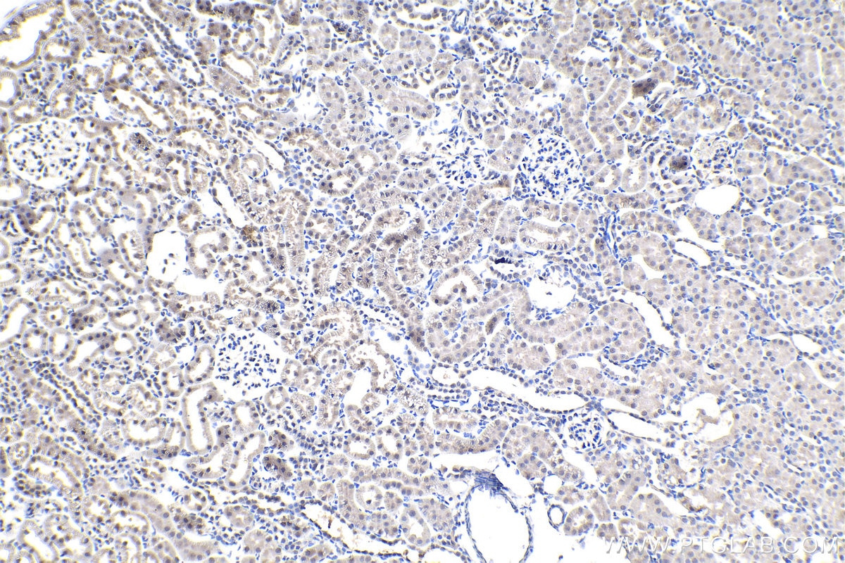 Immunohistochemistry (IHC) staining of rat kidney tissue using Phospho-Histone H3 (Ser10) Monoclonal antibody (66863-1-Ig)