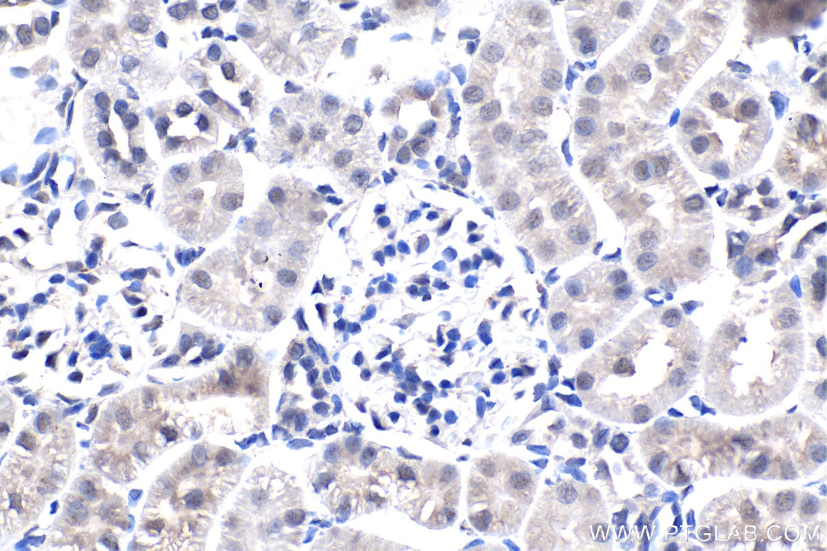 Immunohistochemistry (IHC) staining of rat kidney tissue using Phospho-Histone H3 (Ser10) Monoclonal antibody (66863-1-Ig)