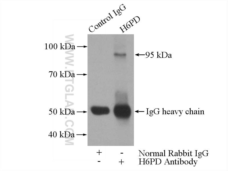 Immunoprecipitation (IP) experiment of HepG2 cells using H6PD Polyclonal antibody (15255-1-AP)