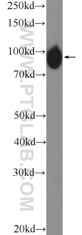 Western Blot (WB) analysis of HepG2 cells using H6PD Polyclonal antibody (15255-1-AP)