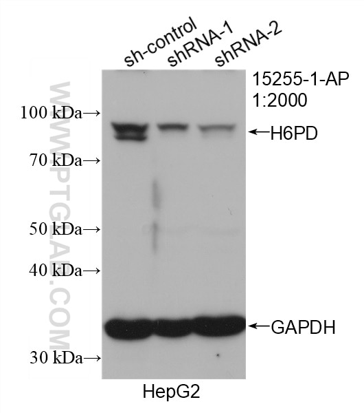 Western Blot (WB) analysis of HepG2 cells using H6PD Polyclonal antibody (15255-1-AP)