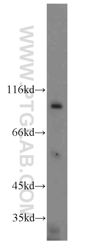 Western Blot (WB) analysis of HeLa cells using H6PD Polyclonal antibody (15255-1-AP)