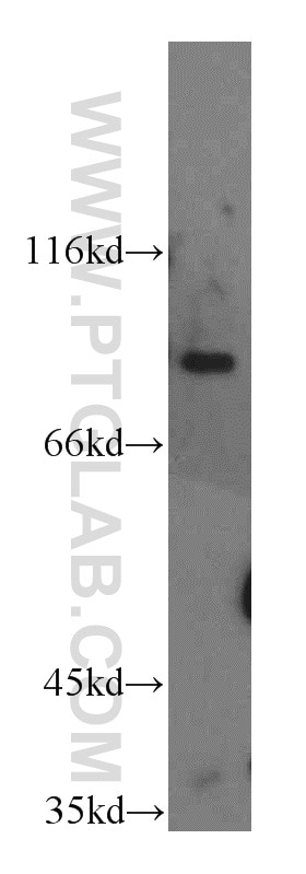 Western Blot (WB) analysis of mouse liver tissue using H6PD Polyclonal antibody (15255-1-AP)