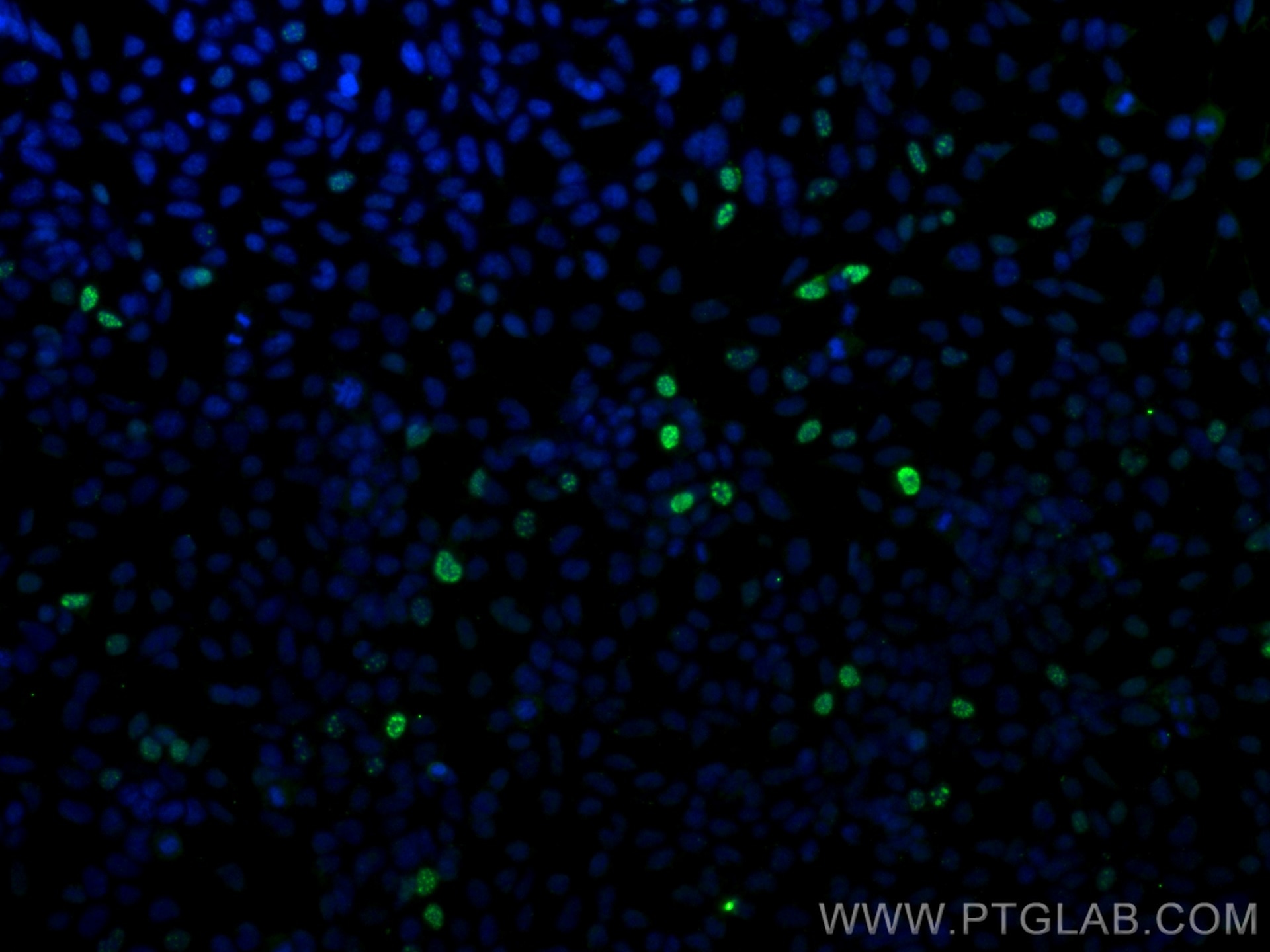 Immunofluorescence (IF) / fluorescent staining of Transfected HEK-293 cells using HA Tag Monoclonal antibody (66006-2-Ig)