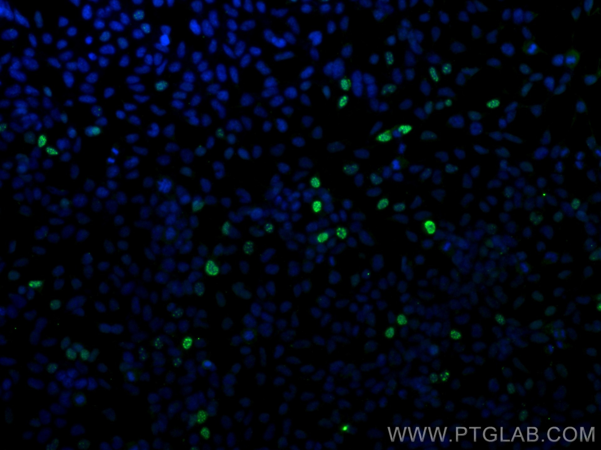 IF Staining of Transfected HEK-293 using 66006-2-Ig