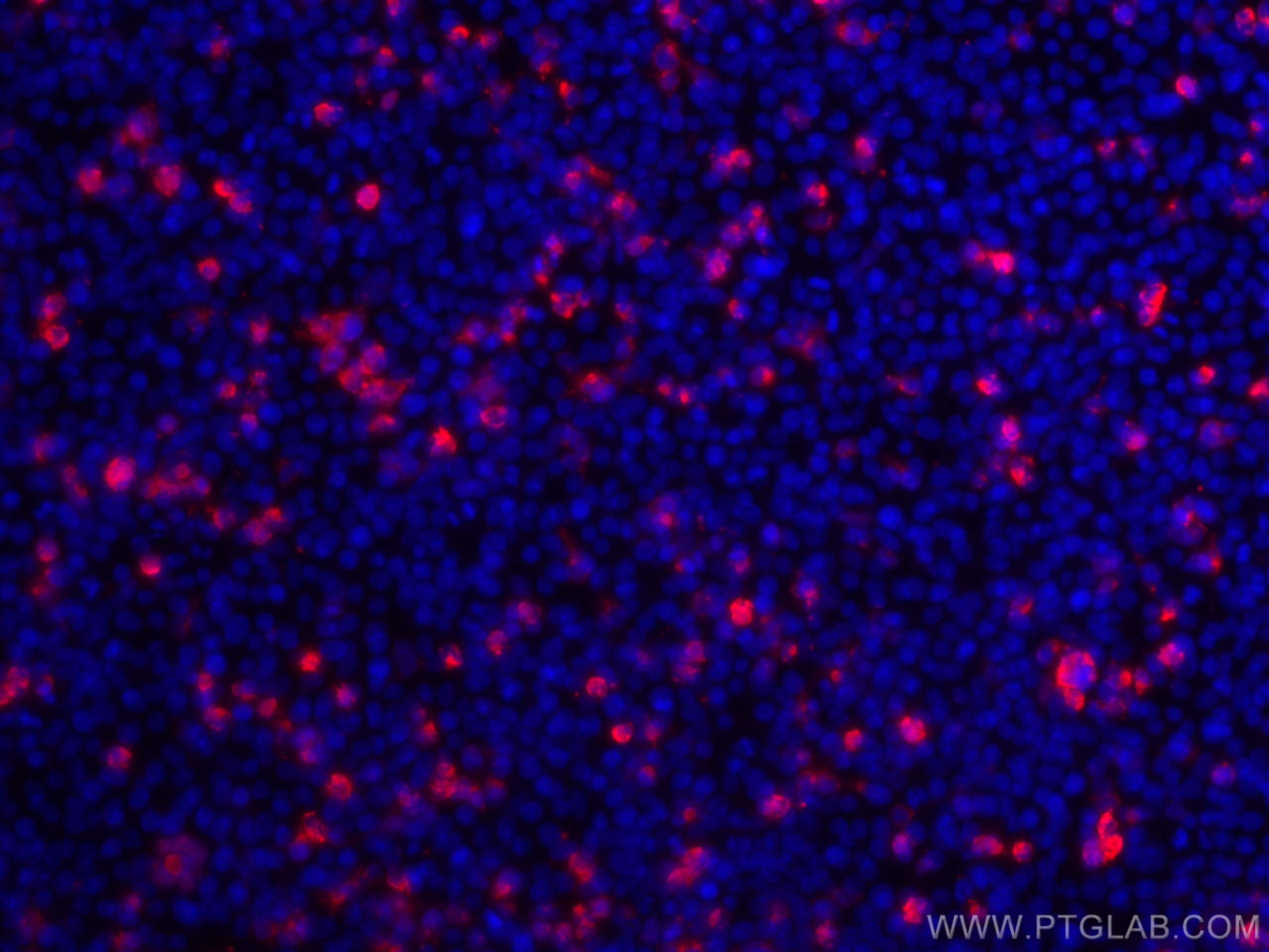 Immunofluorescence (IF) / fluorescent staining of Transfected HEK-293 cells using HA Tag Recombinant antibody (81290-1-RR)