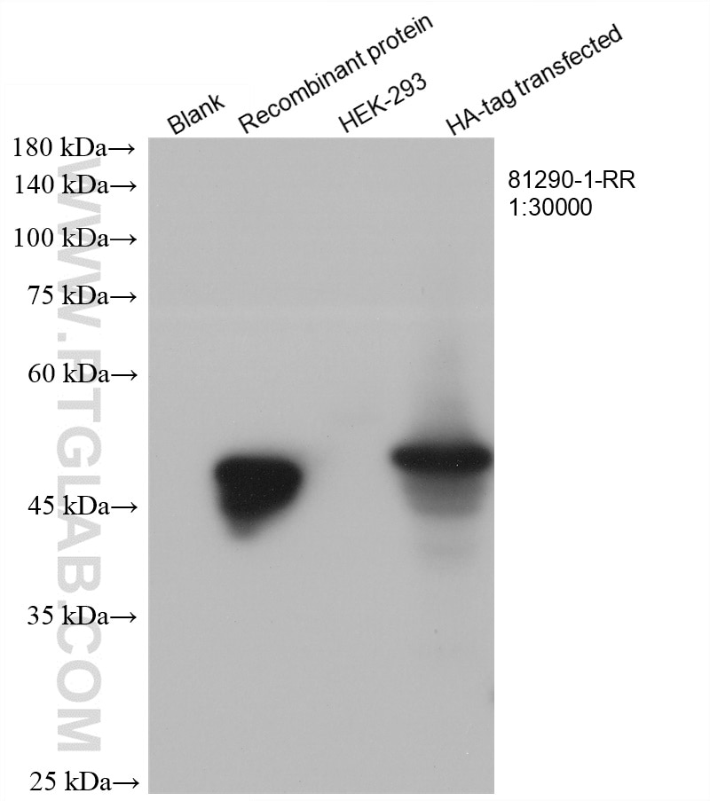 Western Blot (WB) analysis of various lysates using HA Tag Recombinant antibody (81290-1-RR)