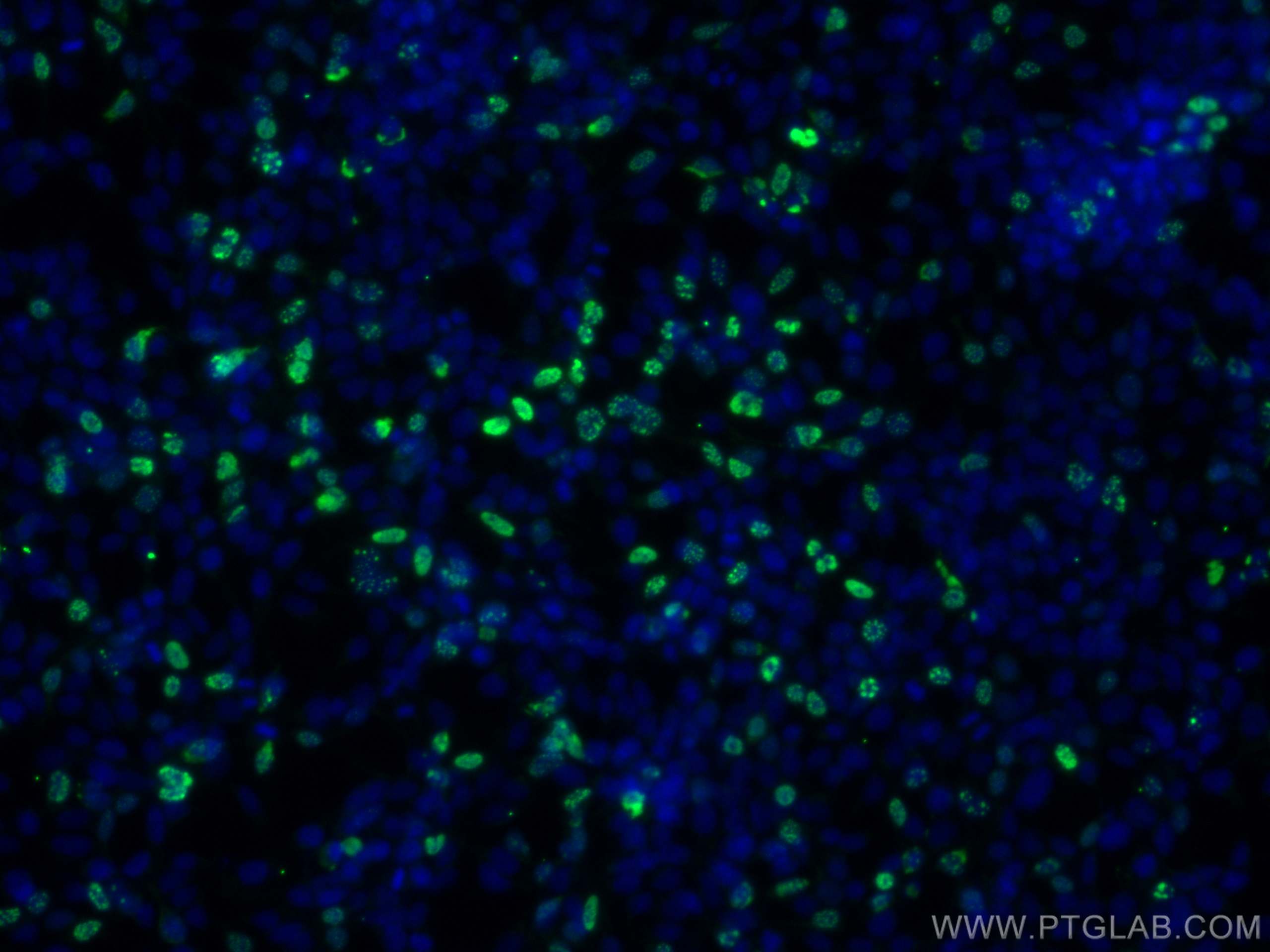Immunofluorescence (IF) / fluorescent staining of Transfected HEK-293 cells using CoraLite® Plus 488-conjugated HA Tag Monoclonal an (CL488-66006)