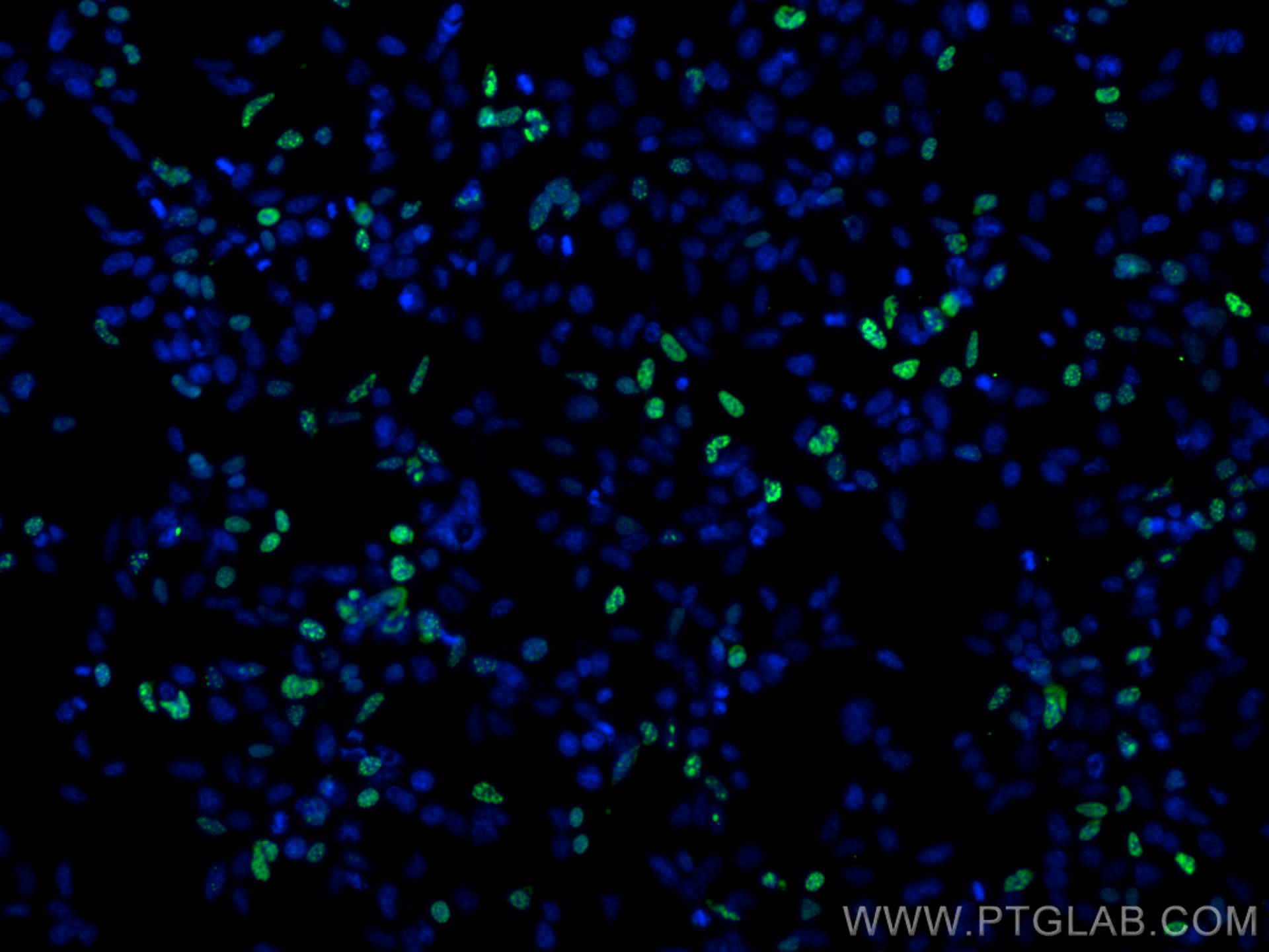 IF Staining of Transfected HEK-293 using CL488-81290