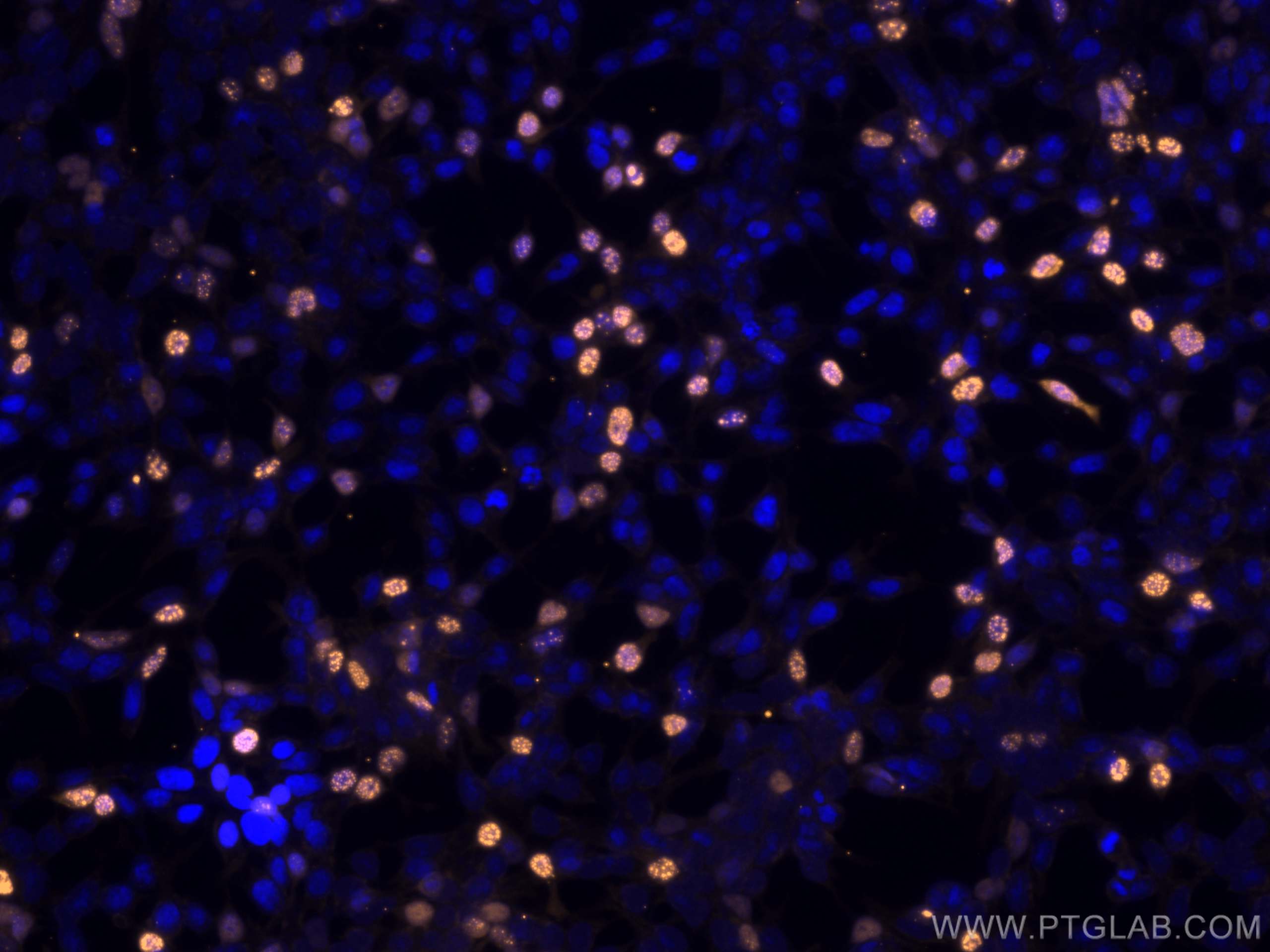 Immunofluorescence (IF) / fluorescent staining of Transfected HEK-293 cells using CoraLite®555-conjugated HA Tag Monoclonal antibody (CL555-66006)