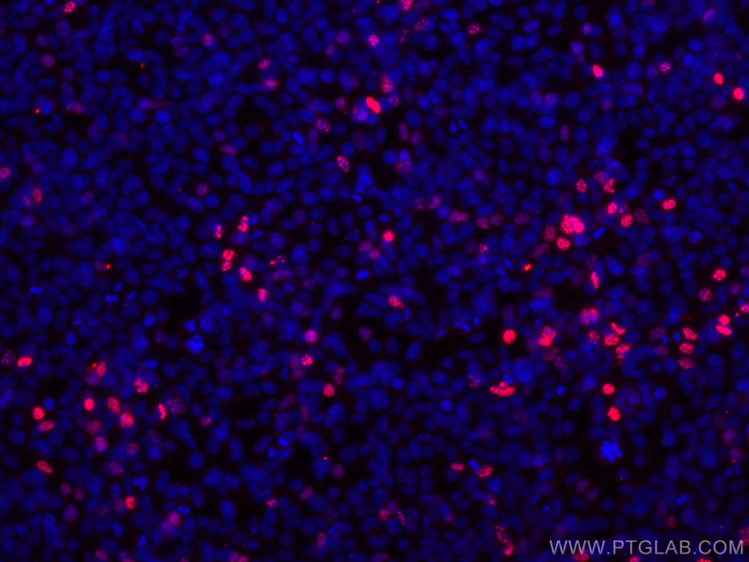 IF Staining of Transfected HEK-293 using CL594-66006