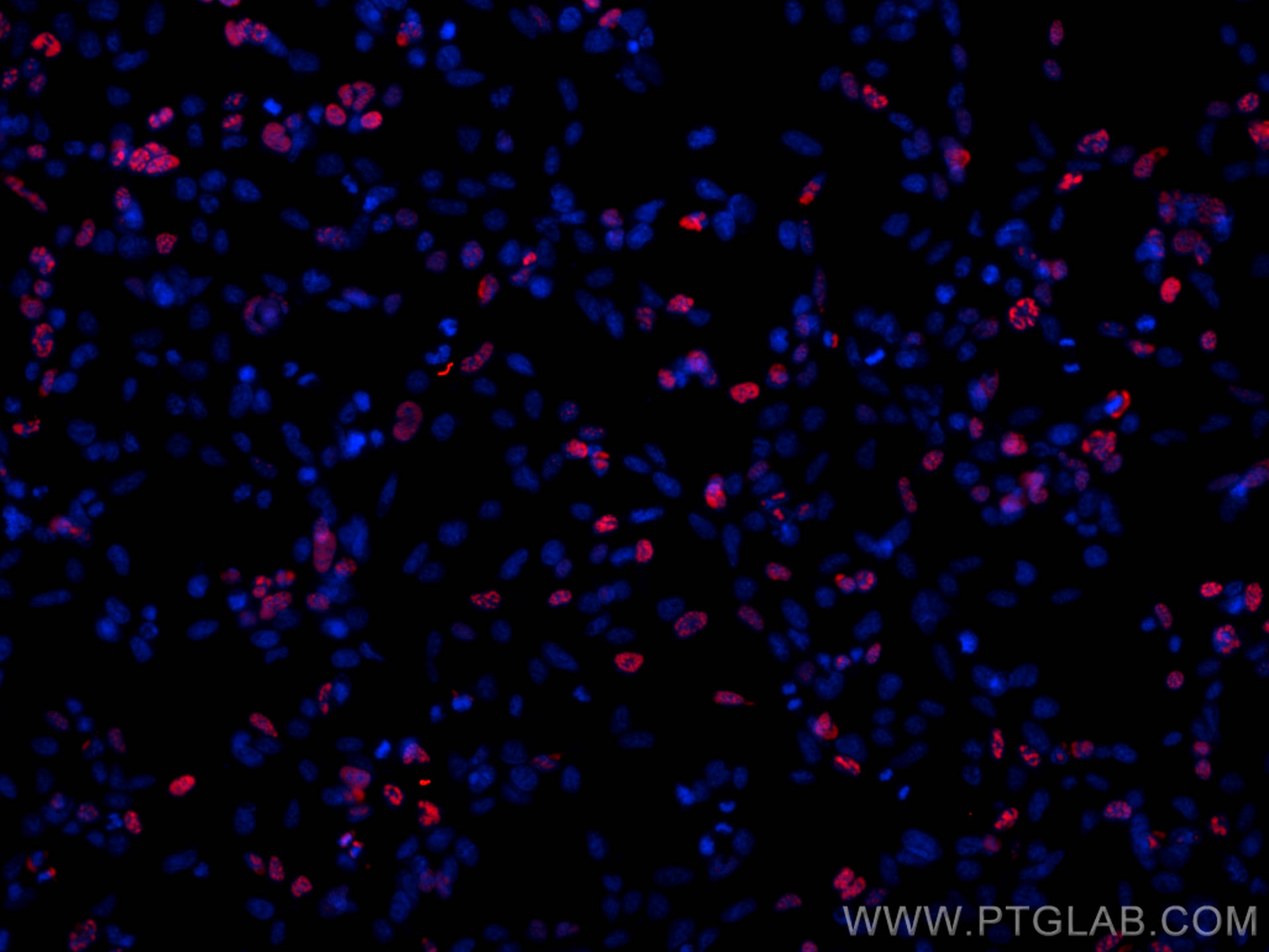 IF Staining of Transfected HEK-293 using CL594-81290