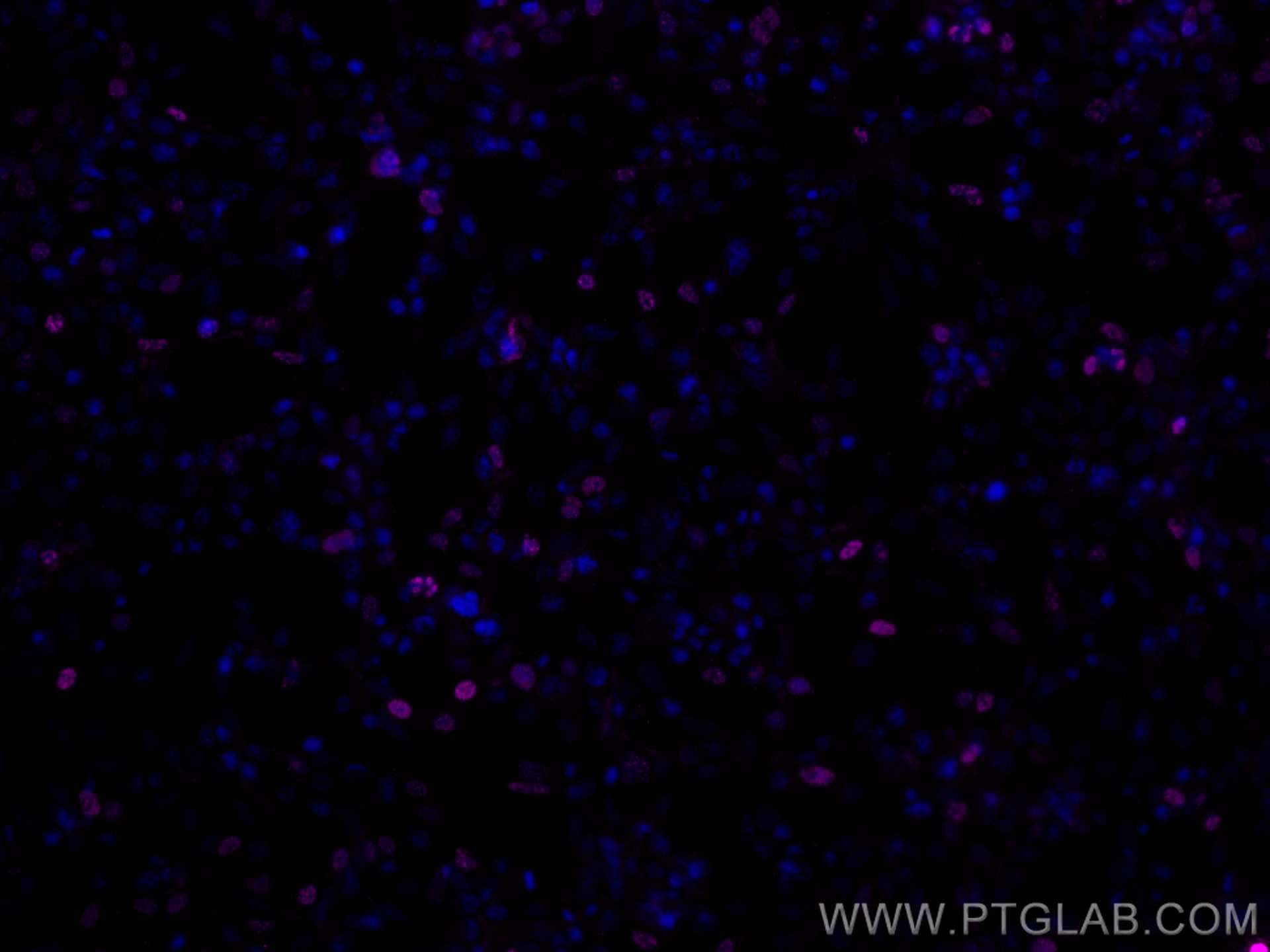 IF Staining of Transfected HEK-293 using CL647-66006