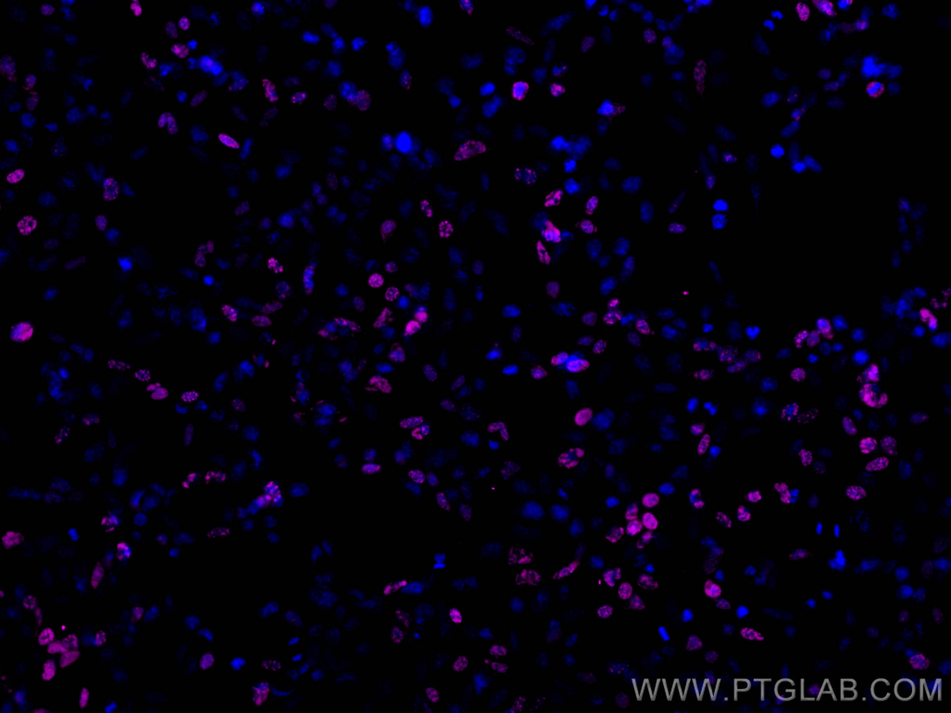 Immunofluorescence (IF) / fluorescent staining of Transfected HEK-293 cells using CoraLite®647-conjugated HA Tag Recombinant antibod (CL647-81290)