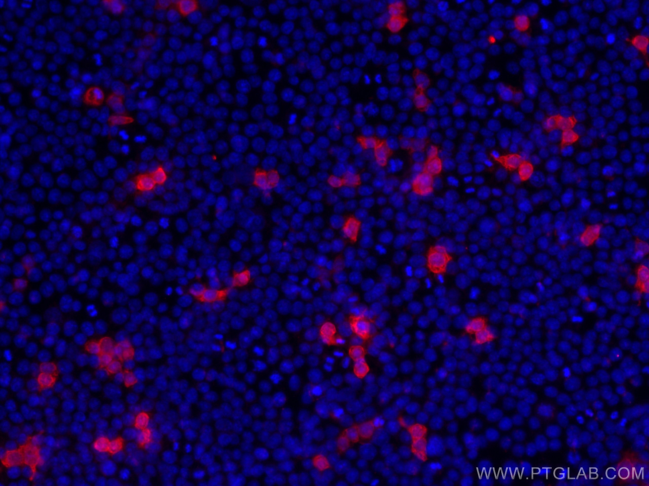 Immunofluorescence (IF) / fluorescent staining of Transfected HEK-293 cells using HA tag Polyclonal antibody (51064-2-AP)