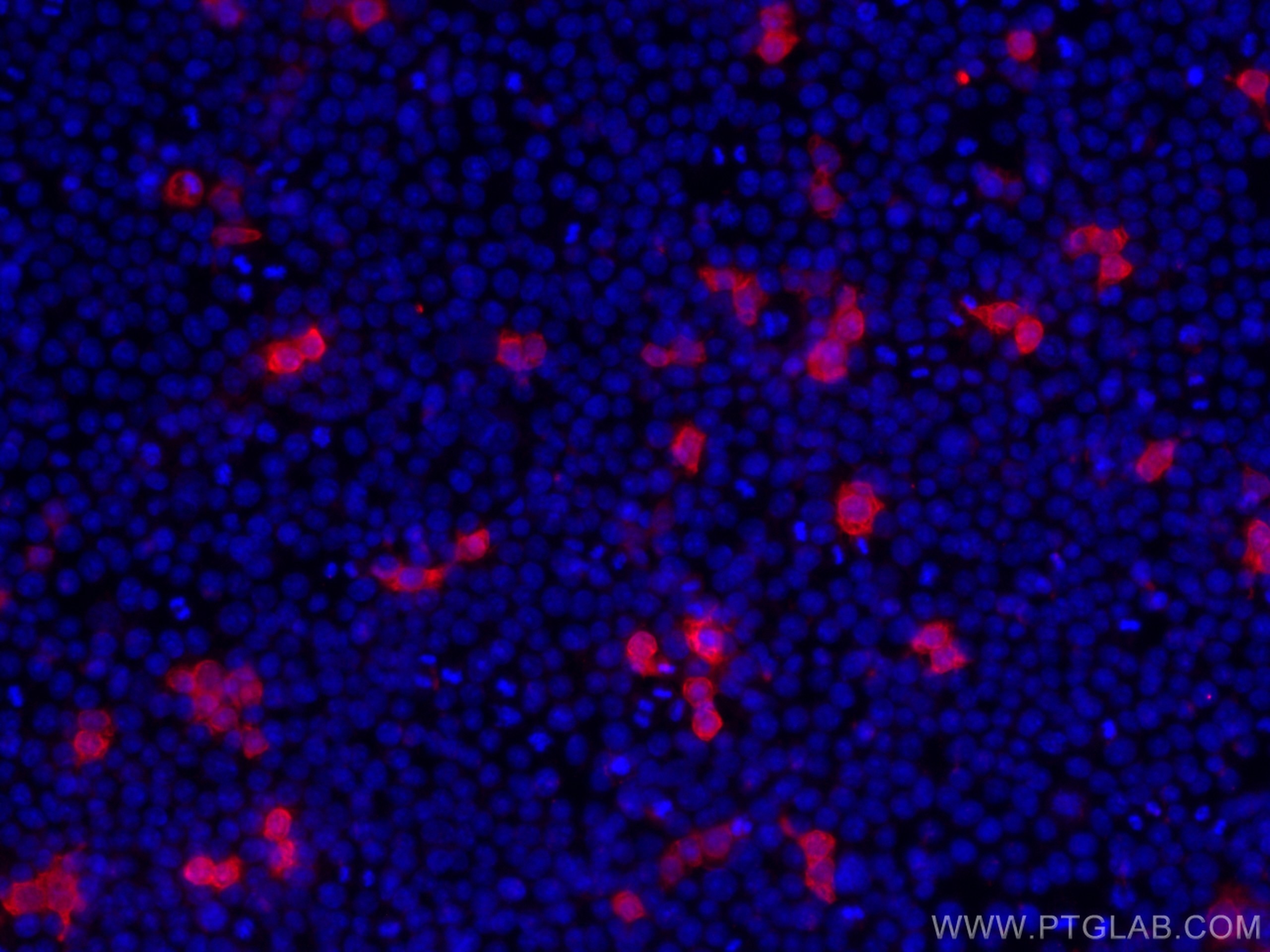 IF Staining of Transfected HEK-293 using 51064-2-AP