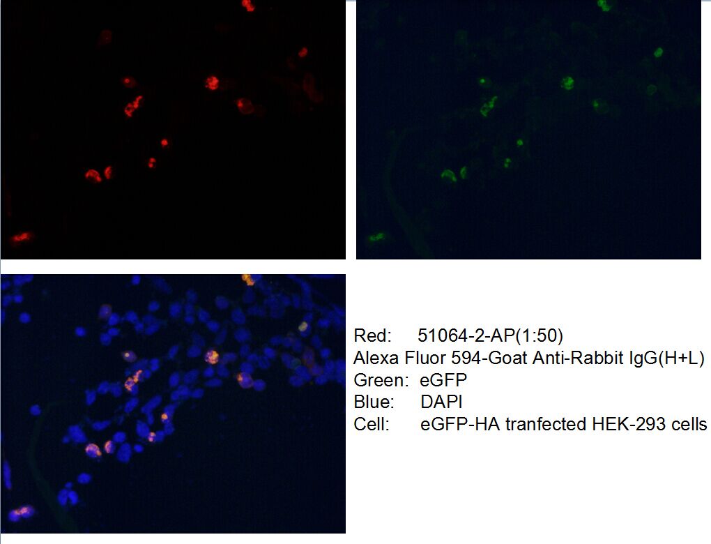 Immunofluorescence (IF) / fluorescent staining of Transfected HEK-293 cells using HA tag Polyclonal antibody (51064-2-AP)
