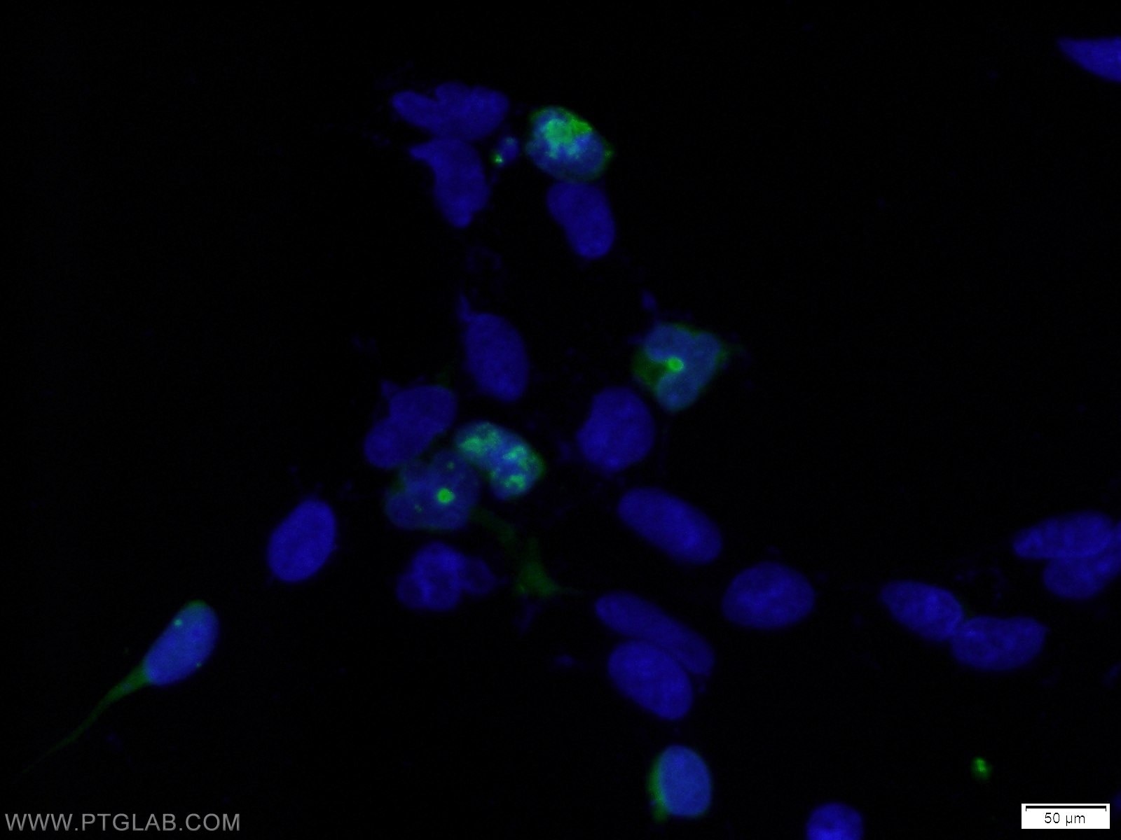 Immunofluorescence (IF) / fluorescent staining of Transfected HEK-293 cells using HA tag Polyclonal antibody (51064-2-AP)