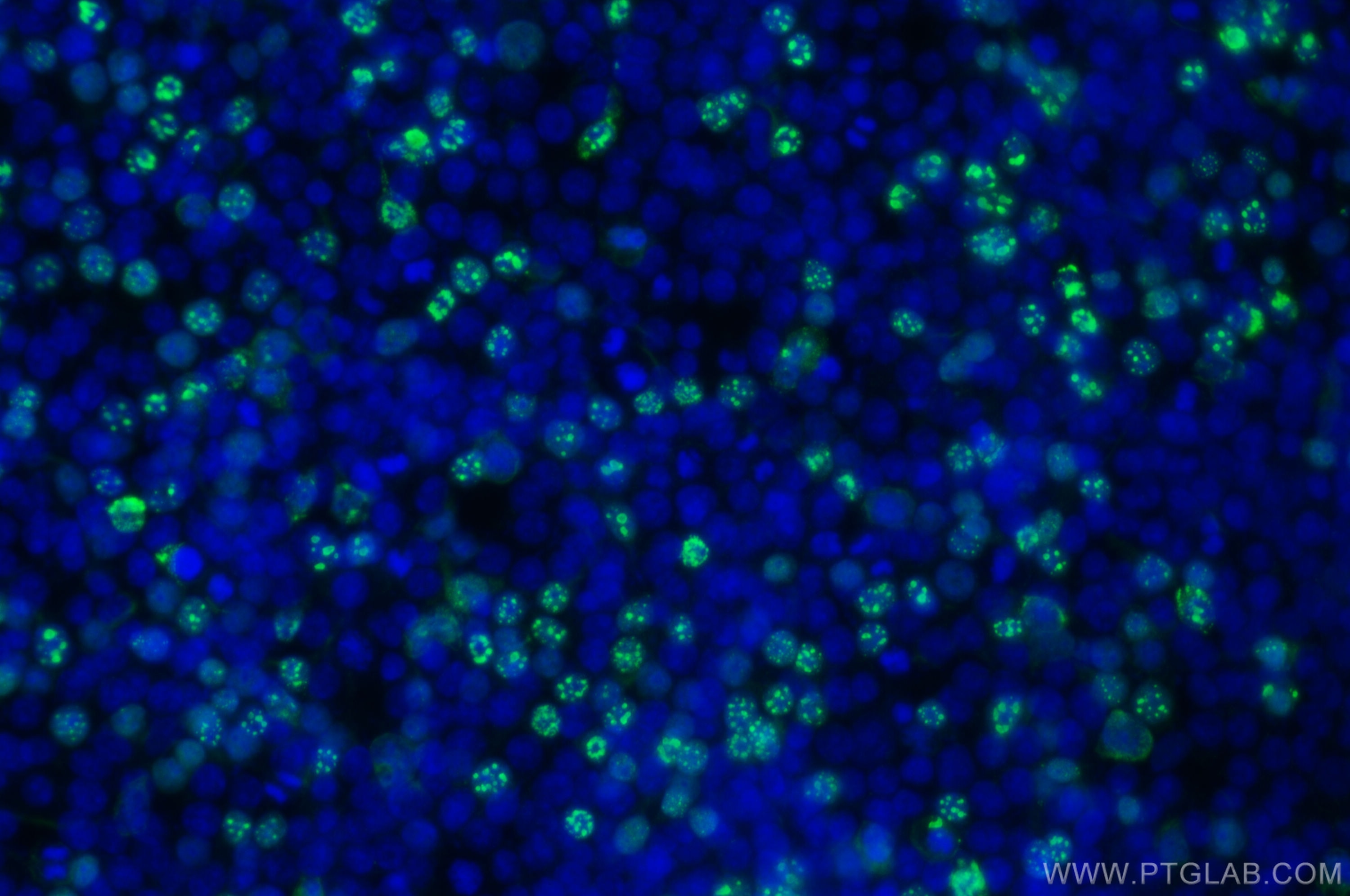 Immunofluorescence (IF) / fluorescent staining of Transfected HEK-293 cells using HA tag Polyclonal antibody (51064-2-AP)