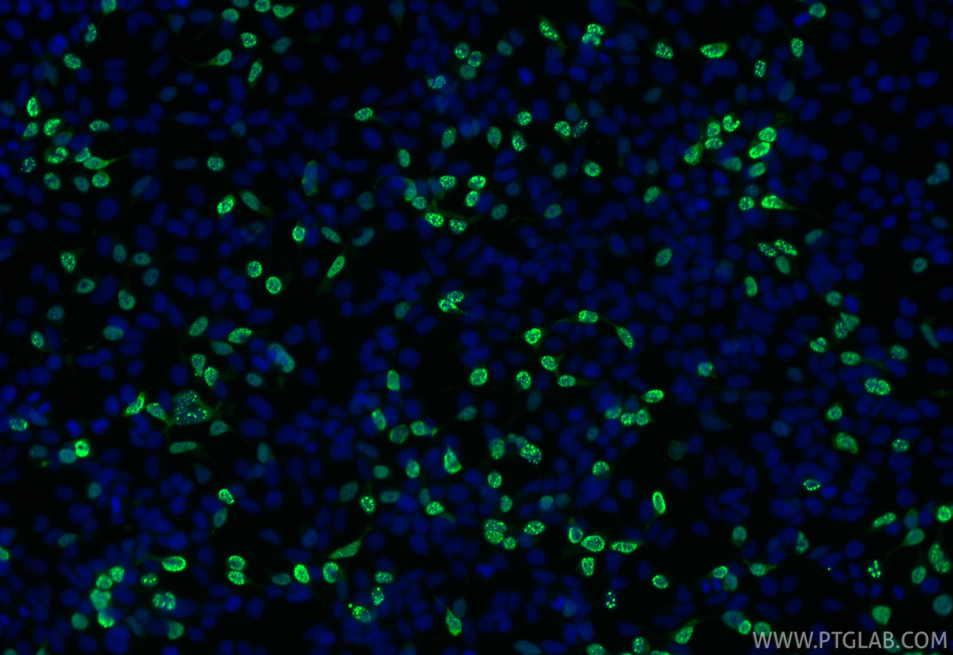 Immunofluorescence (IF) / fluorescent staining of Transfected HEK-293 cells using HA tag Polyclonal antibody (51064-2-AP)