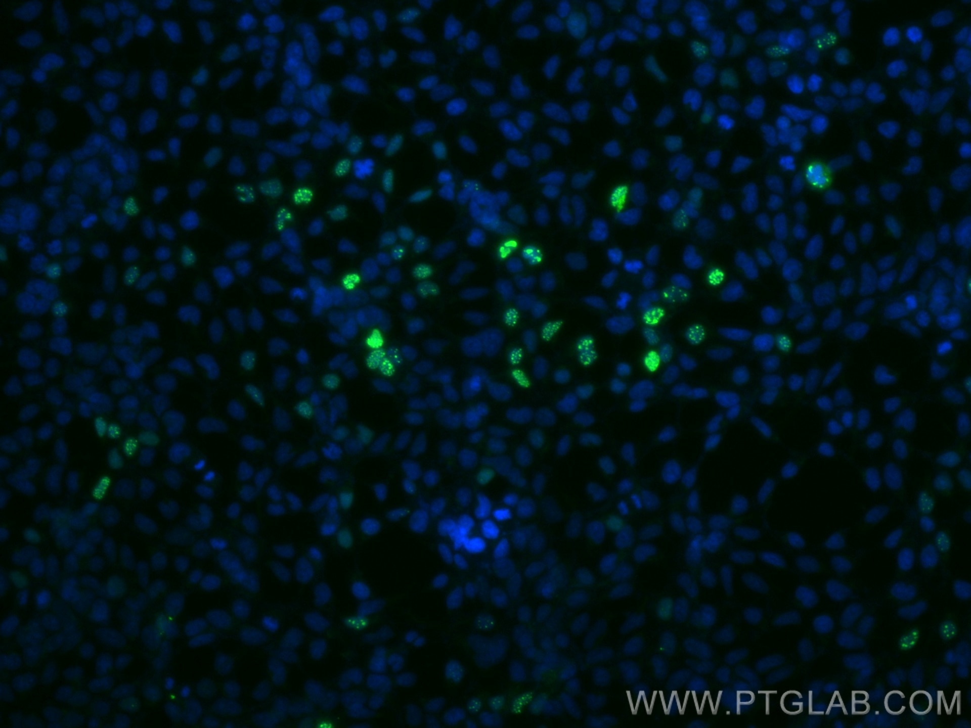 Immunofluorescence (IF) / fluorescent staining of Transfected HEK-293 cells using CoraLite® Plus 488-conjugated HA tag Polyclonal an (CL488-51064)