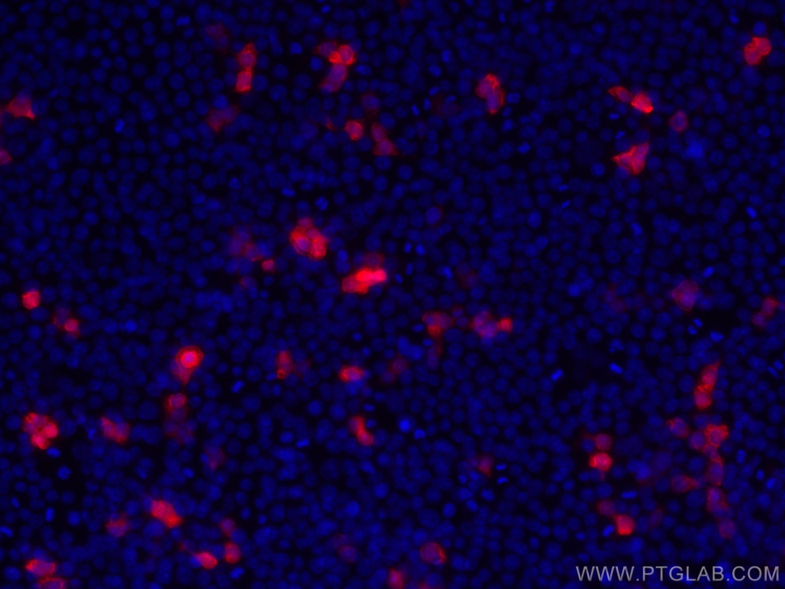 Immunofluorescence (IF) / fluorescent staining of Transfected HEK-293 cells using CoraLite®594-conjugated HA tag Polyclonal antibody (CL594-51064)