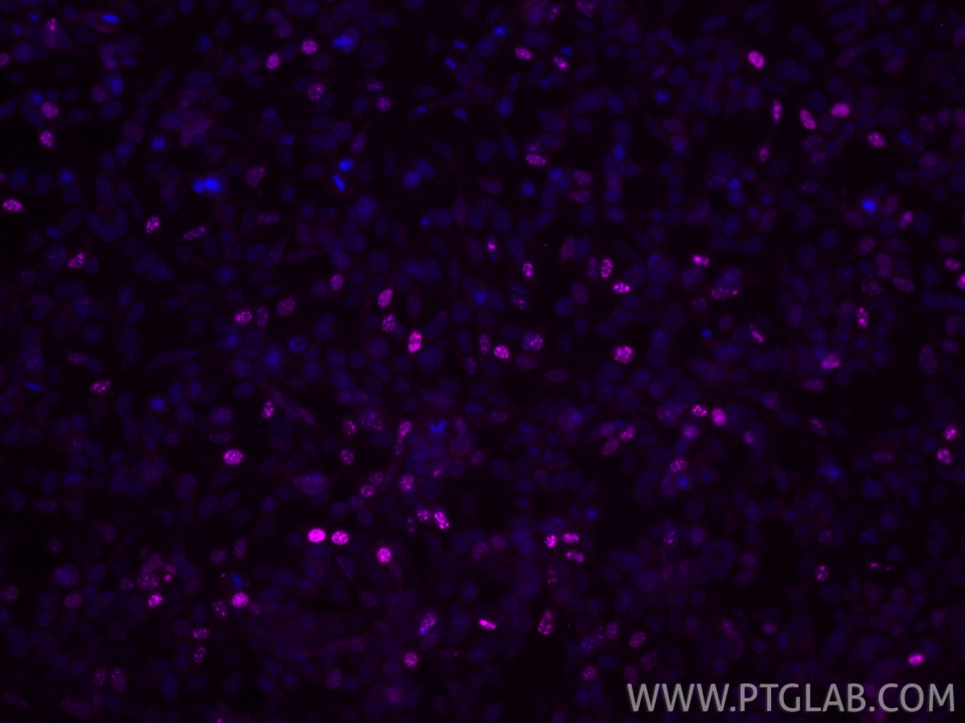 Immunofluorescence (IF) / fluorescent staining of Transfected HEK-293 cells using CoraLite® Plus 647-conjugated HA tag Polyclonal an (CL647-51064-2)