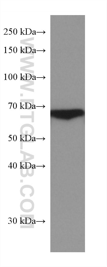 Western Blot (WB) analysis of human plasma using HABP2 Monoclonal antibody (67867-1-Ig)
