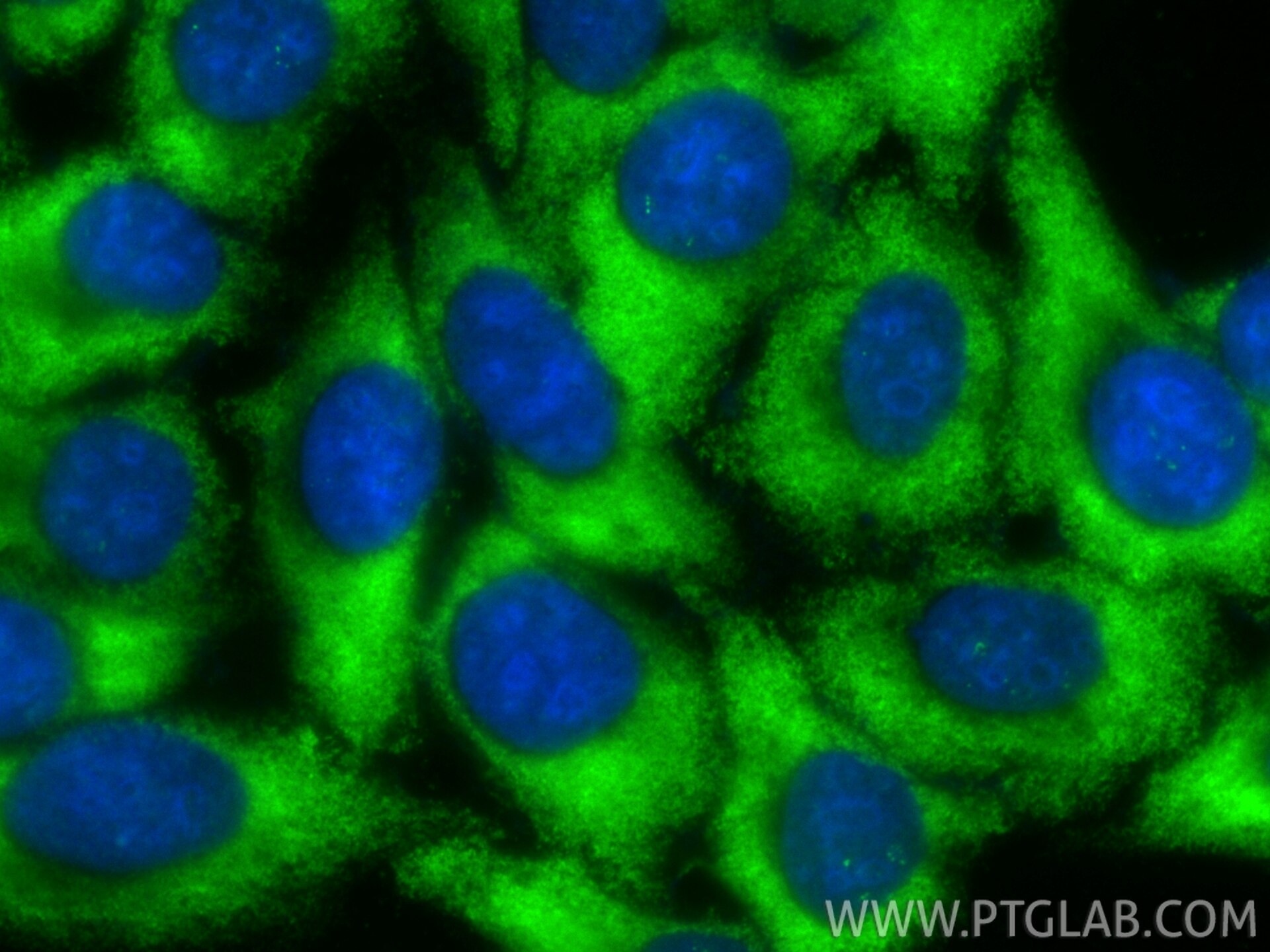Immunofluorescence (IF) / fluorescent staining of HepG2 cells using CoraLite® Plus 488-conjugated HABP2 Monoclonal ant (CL488-67867)