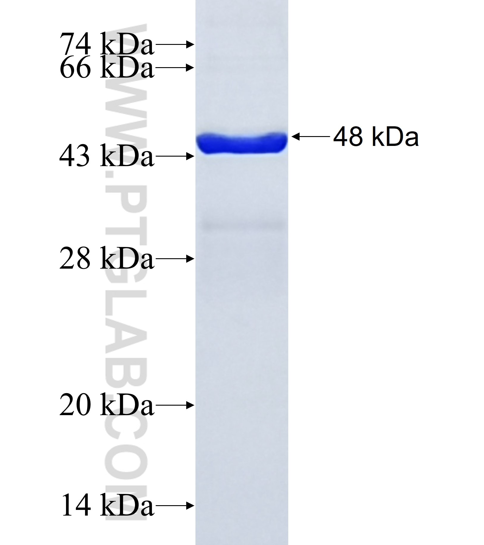 HABP2 fusion protein Ag33062 SDS-PAGE HABP2 fusion protein Ag33062 SDS-PAGE