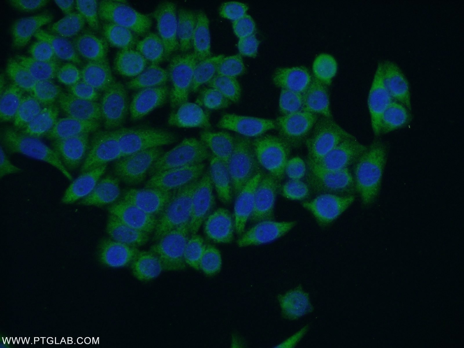 Immunofluorescence (IF) / fluorescent staining of HeLa cells using HACE1 Polyclonal antibody (24104-1-AP)