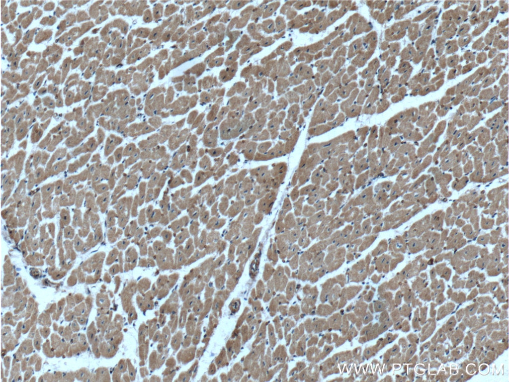 Immunohistochemistry (IHC) staining of human heart tissue using HACE1 Polyclonal antibody (24104-1-AP)