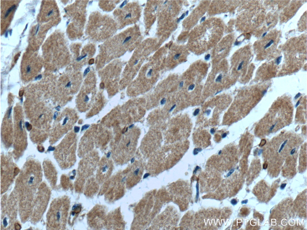 Immunohistochemistry (IHC) staining of human heart tissue using HACE1 Polyclonal antibody (24104-1-AP)