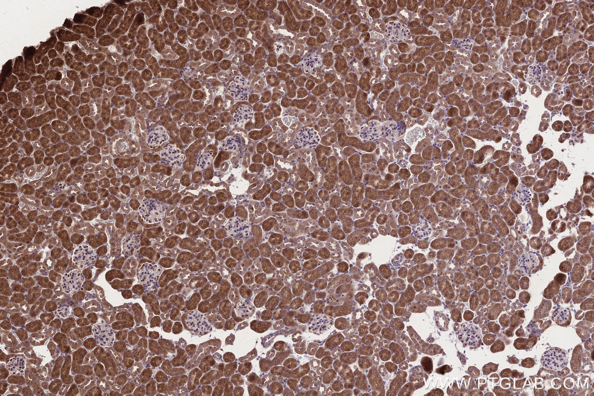 Immunohistochemistry (IHC) staining of mouse kidney tissue using HACE1 Polyclonal antibody (24104-1-AP)