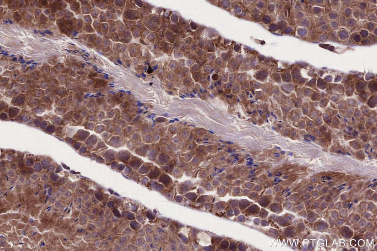 Immunohistochemistry (IHC) staining of mouse testis tissue using HACE1 Polyclonal antibody (24104-1-AP)
