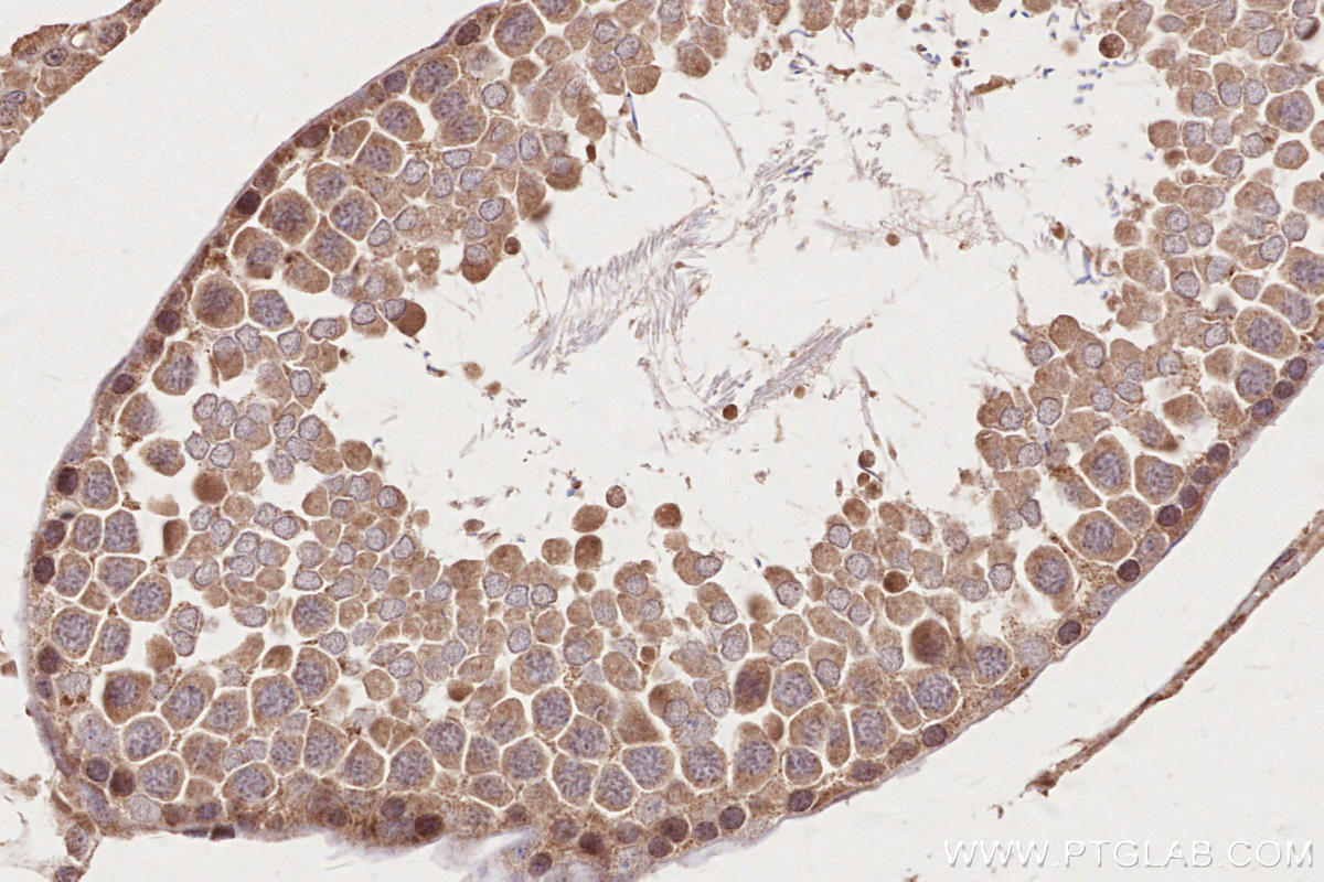 Immunohistochemistry (IHC) staining of rat testis tissue using HACE1 Polyclonal antibody (24104-1-AP)