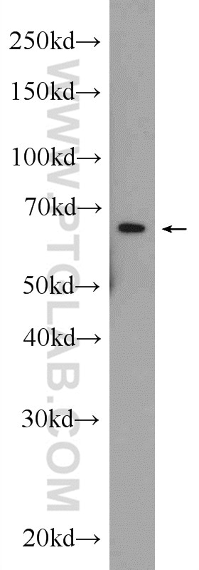 Western Blot (WB) analysis of HEK-293 cells using HACE1 Polyclonal antibody (24104-1-AP)