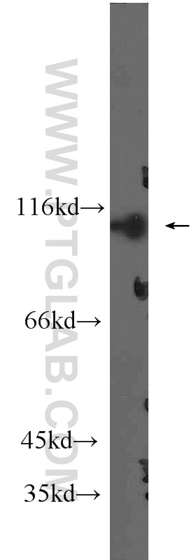 Western Blot (WB) analysis of HeLa cells using HACE1 Polyclonal antibody (24104-1-AP)