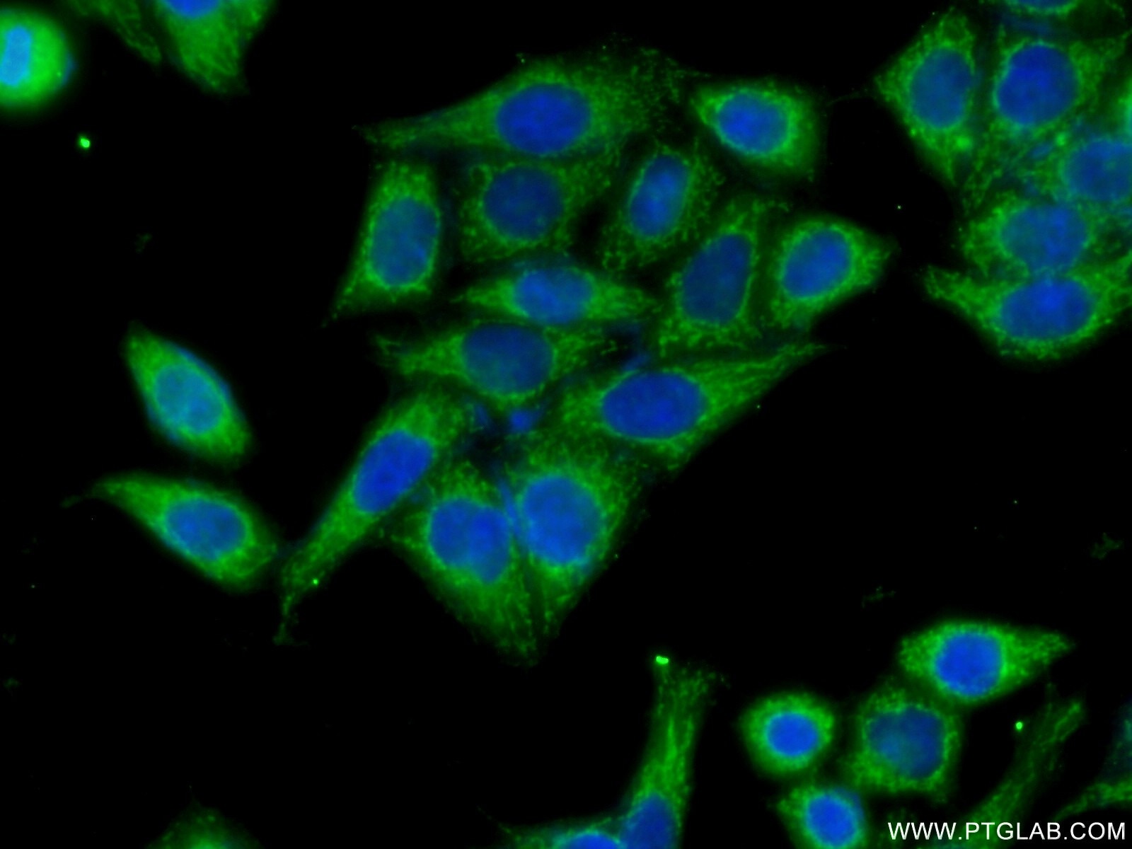 Immunofluorescence (IF) / fluorescent staining of HeLa cells using HACL1 Polyclonal antibody (15519-1-AP)