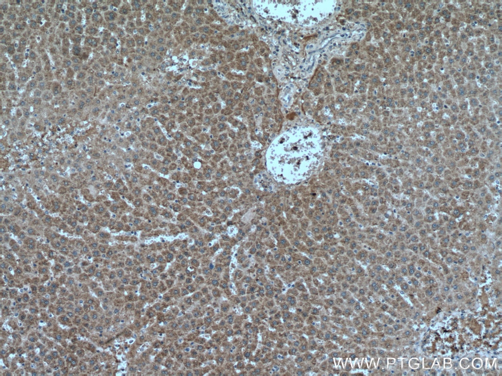 Immunohistochemistry (IHC) staining of rat liver tissue using HACL1 Polyclonal antibody (15519-1-AP)